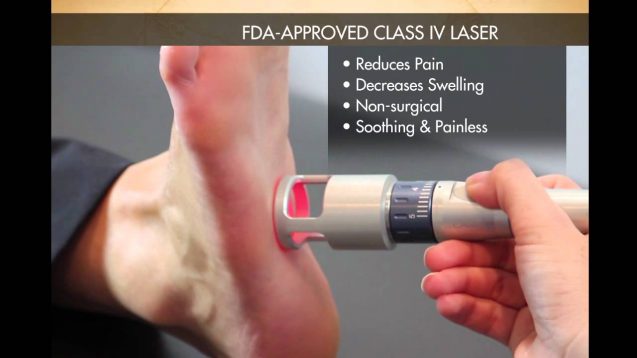 Plantar Fasciiitis & K – Laser Therapy